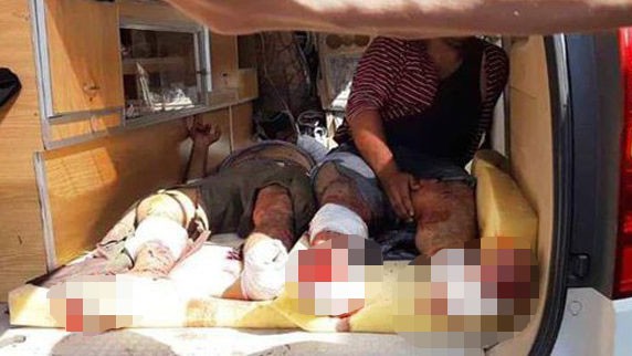 Người dân Syria bị thương do các cuộc bắn pháo của quân đội Thổ Nhĩ Kỳ ngày 18/10.